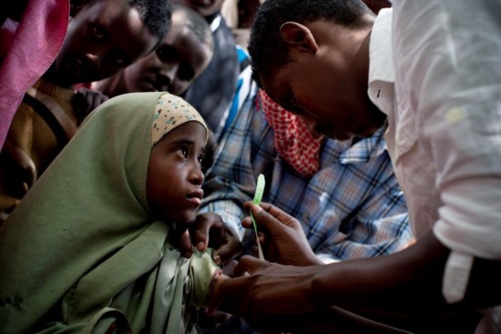 Caption to come. Photographer's caption (NOT FACTED CHECKED): A young girl has her arm measured at a nutritional assessment organised by DIAL, a local NGO who is a partner of UNICEF, at a weekly assessment held in the town centre in Ras Kamboni, Somalia on the 6th July, 2012. Ras Kamboni has seen no foreign assistance or development aid for the last fifteen years, The Kenyan Military took control of Ras Kamboni in October last year, when they first crossed the border into Somalia.