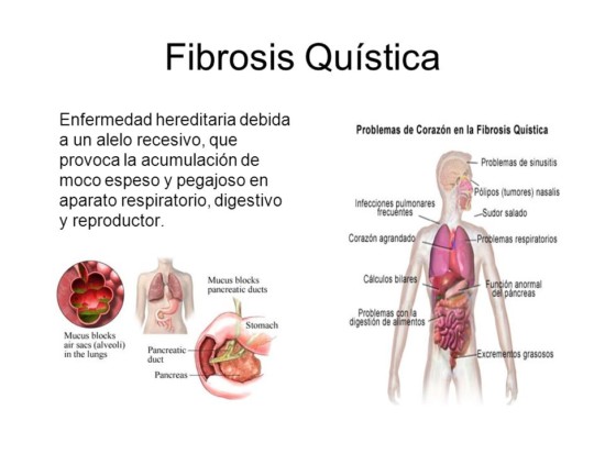 fibrosis (1)